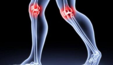 Prevention of arthritis and osteoarthritis development