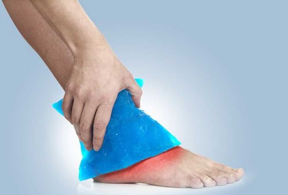 cold bath for ankle osteoarthritis