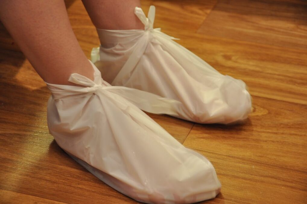 compresses for ankle osteoarthritis