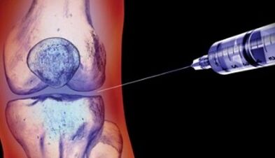 methods to treat joint osteoarthritis