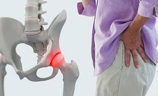 causes of osteoarthritis of the hip joint